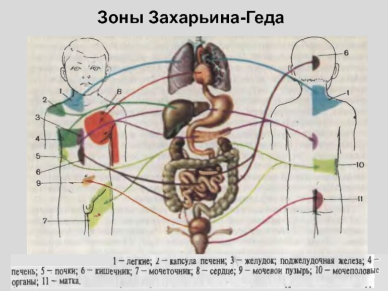 Диагностика здоровья зоны Захарьина-Геда